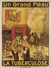 la tuberculose, un grand fléau (1918)